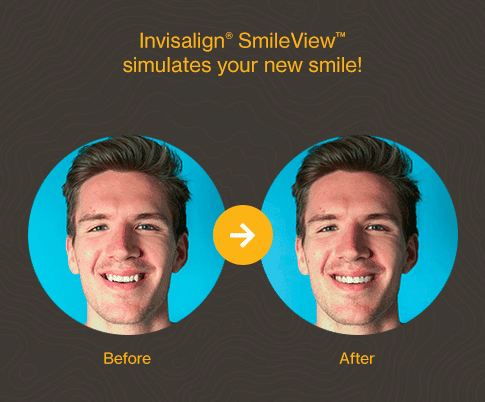 The SmileView App, 